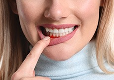 A woman with closed eyes holding a picture of inflamed gums in front of herself