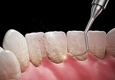 A dentist explaining a woman’s treatment options