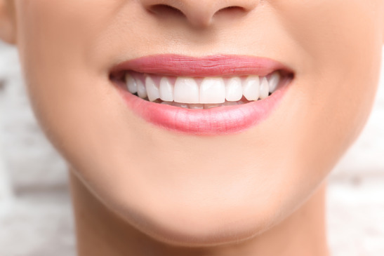 person smiling after getting a dental bridge 